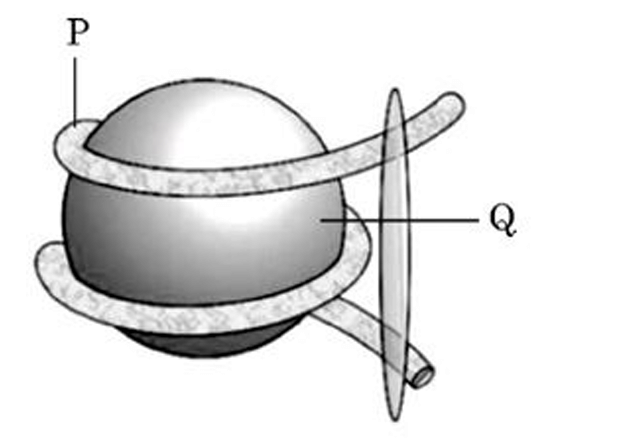 nucleosome