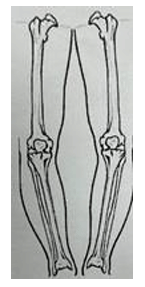 Body part