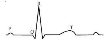  standard ECG of a normal person